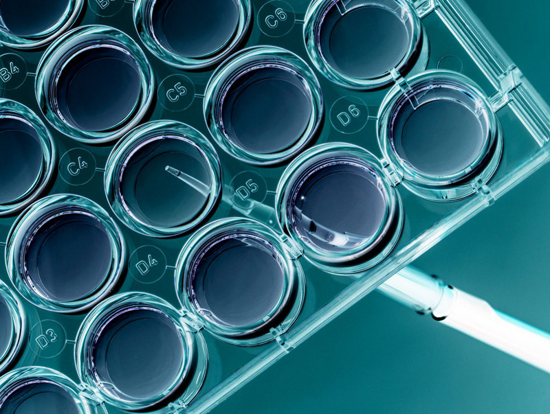 Science-Pipette-Petridish